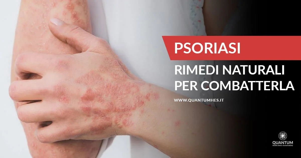 Banner - Psoriasi