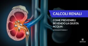 Banner - Calcoli Renali