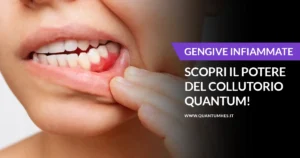 Banner - Collutorio - Gengive infiammate